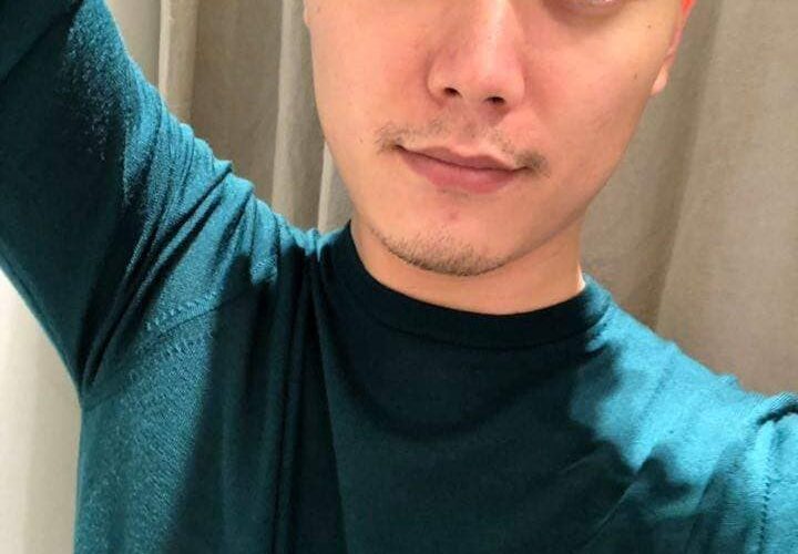 Mẹo CHỮA Viêm Da Dầu (VIÊM DA TIẾT BÃ) khỏi 100% không cần thuốc Tây miễn phí.